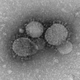 Mers: New virus 'not following Sars' path